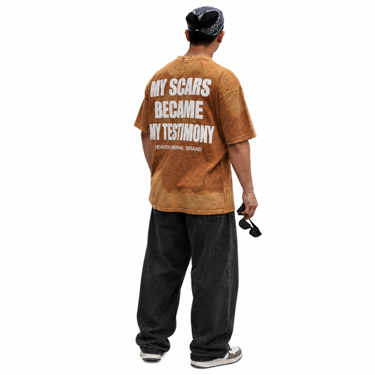 MY SCARS BECAME MY TESTIMONY - CAMOUFLAGE