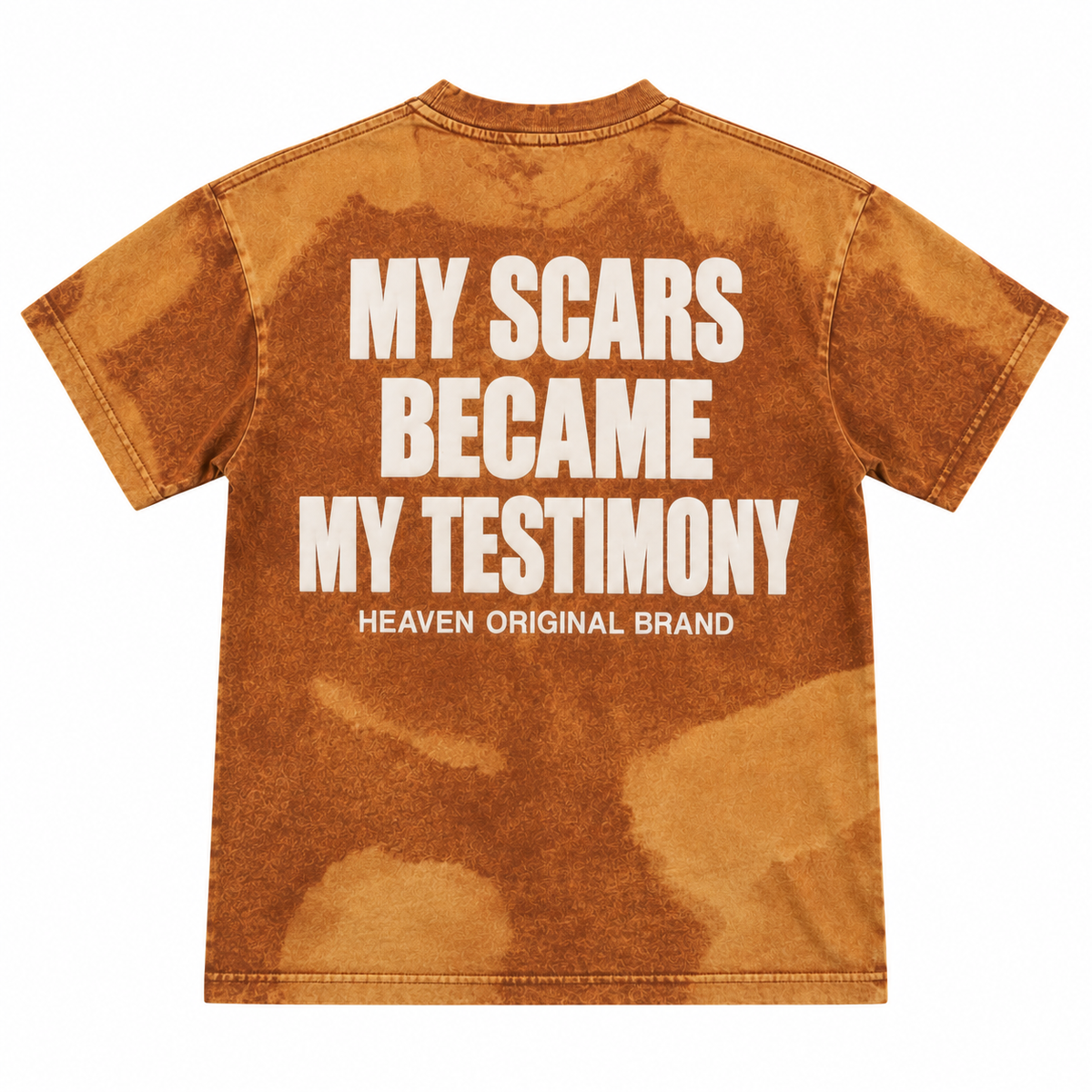 MY SCARS BECAME MY TESTIMONY - CAMOUFLAGE